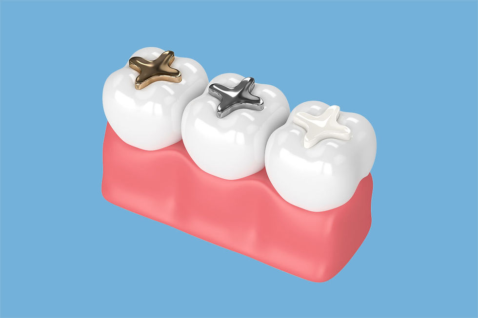 Fillings 3D.jpg