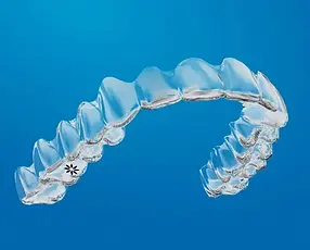 Invisalign 3D.webp