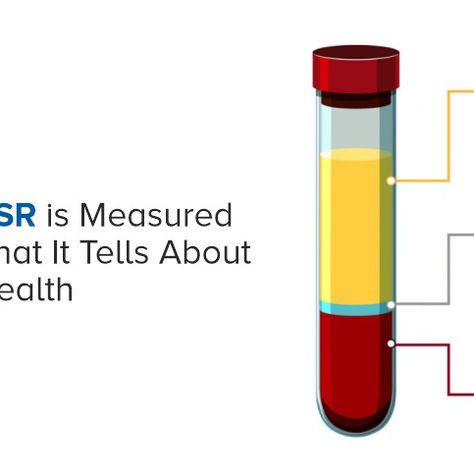 ESR: The Old Test That Still Has Something to Say