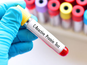 The Inflammation Number Your Doctor Should Be Checking