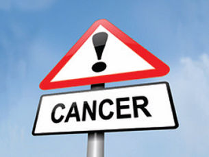QCancer: The Cancer Risk Calculator Your Doctor Can Run Right Now