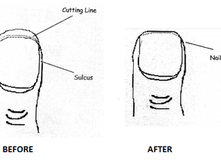 Safe Way To Cut Nails