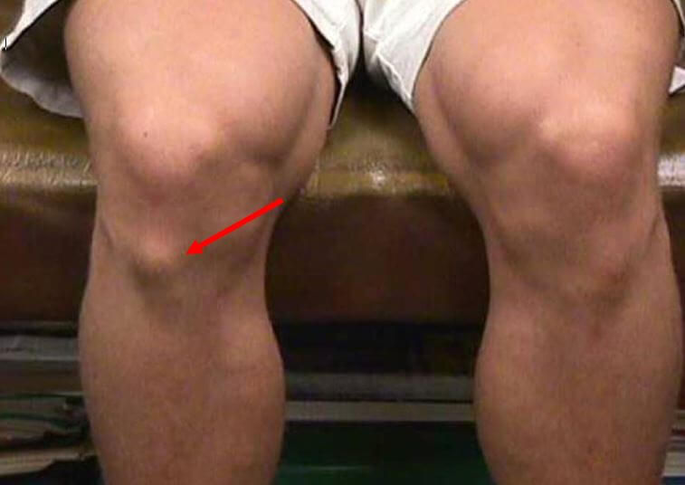 Passion Podiatry | 4 Common Categories of Sports Injuries in Children