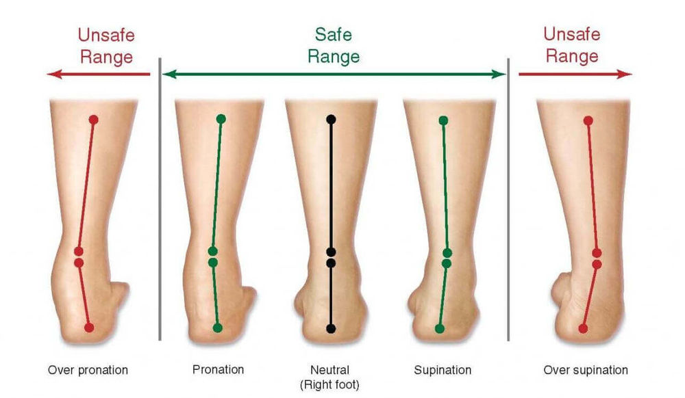 Understanding Your Foot Type & How It Affects You