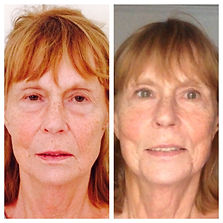 Facial Massage Before and after pics.jpeg