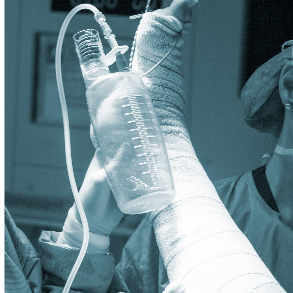 Knee Surgery | Post Operation Care | Knee Arthroscopy | Bangalore