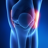 MPFL Knee Injury | The Orthopaedic Clinic | Bangalore