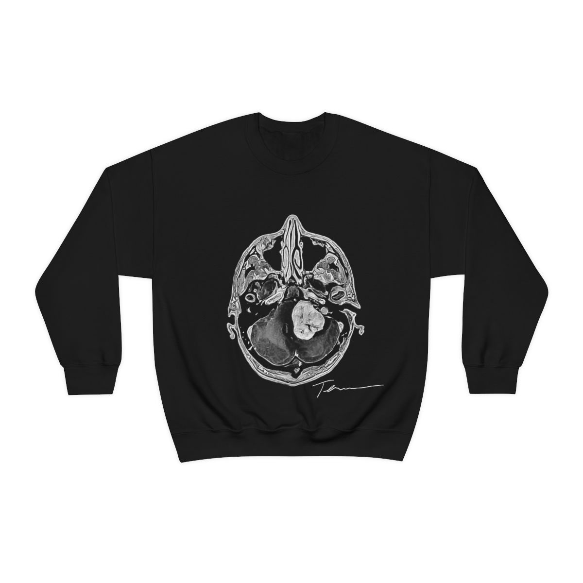 Terry's Tumor Crewneck