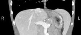 ct_whole_body.jpg