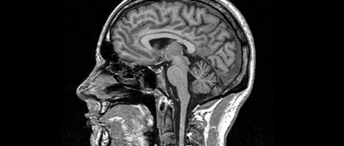 mri.png