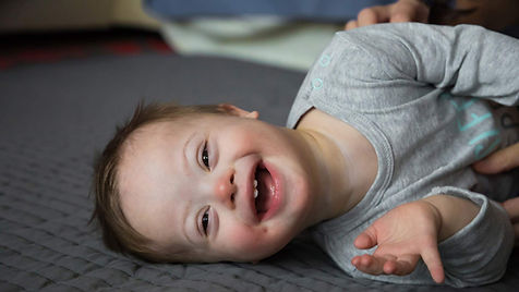 down-sendromu-nedir-hamilelikte-down-sen