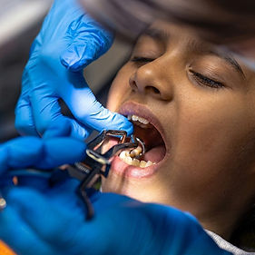 Dental Braces Treatment Process.jpg