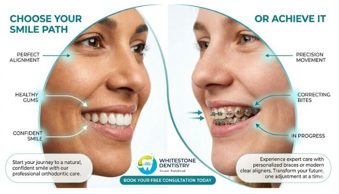 Invisalign vs Traditional Braces