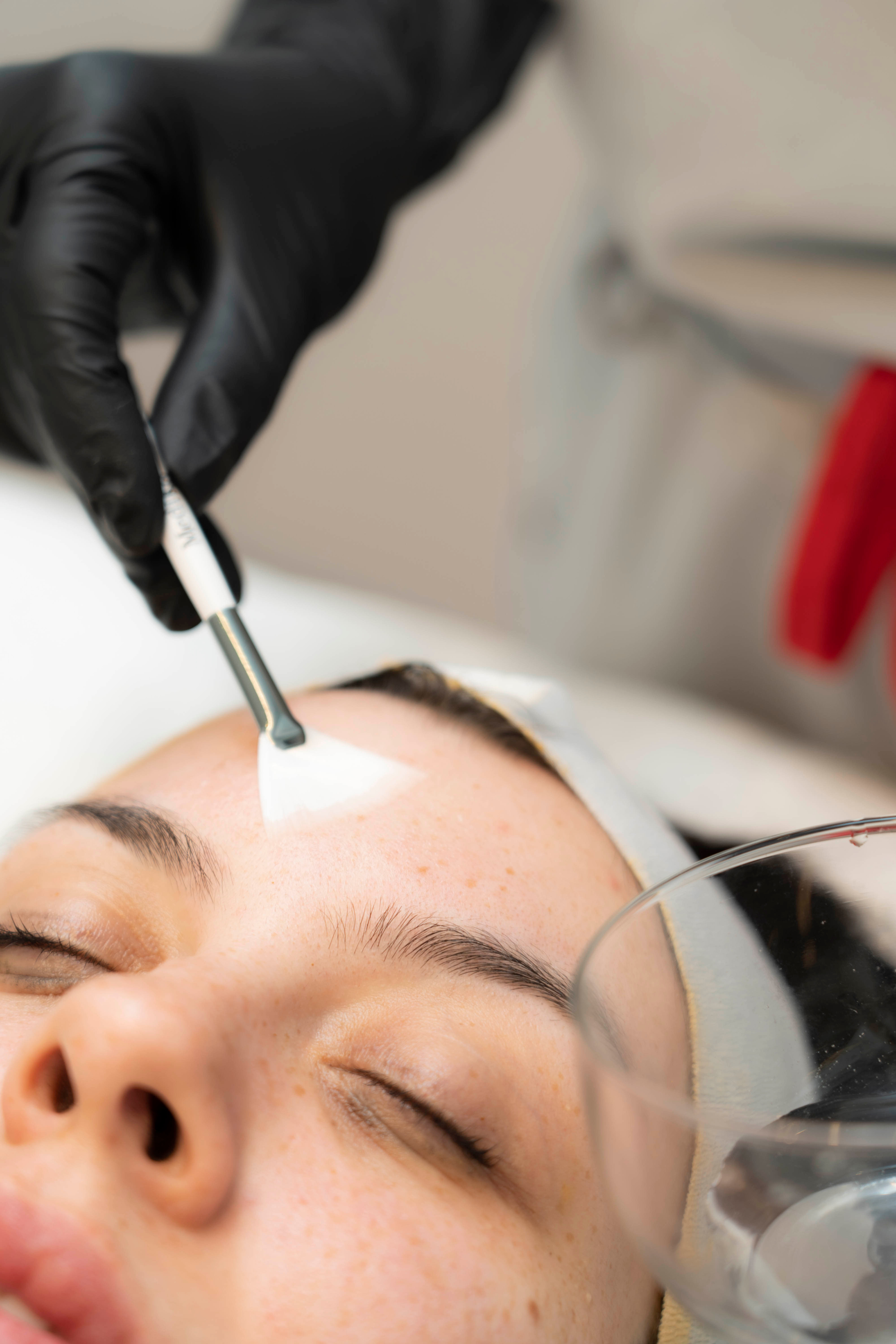 MEDIK8 CHEMICAL PEEL