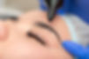 plasma-treatment.jpg