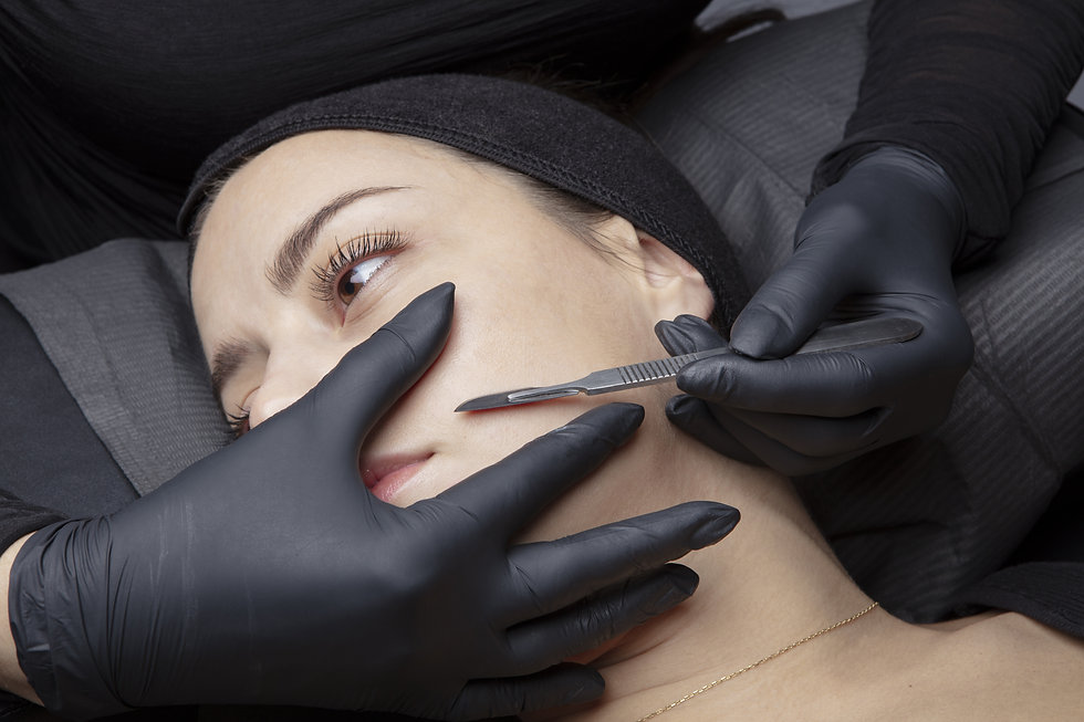 Microneedling