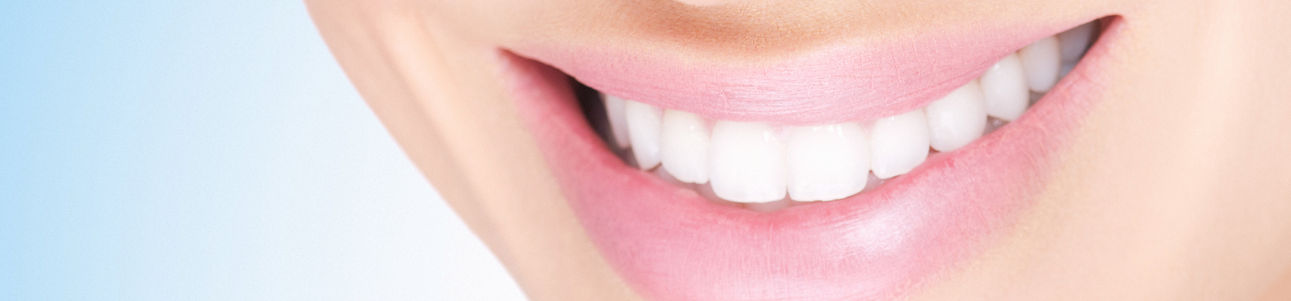 White Smile