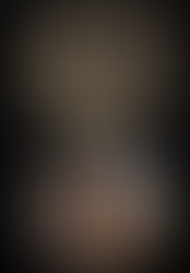 Did you know dental crowding happened 12000 years ago?