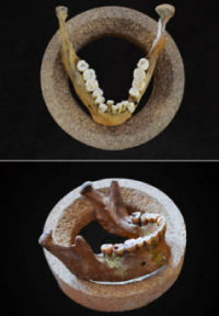 Did you know dental crowding happened 12000 years ago?