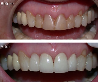 Ross H. Dixon, DDS Dental Crowns Cosmetic Dentistry