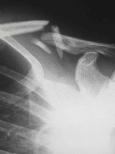 Case Study: No Injuries? No Medical Malpractice