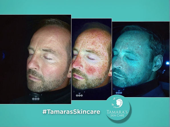 In-depth Skin Analysis_edited.jpg