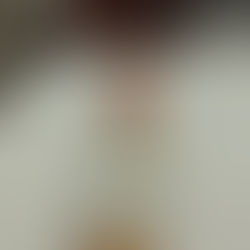 Gros plan sur une cheville blessée avec un sac de glaçons