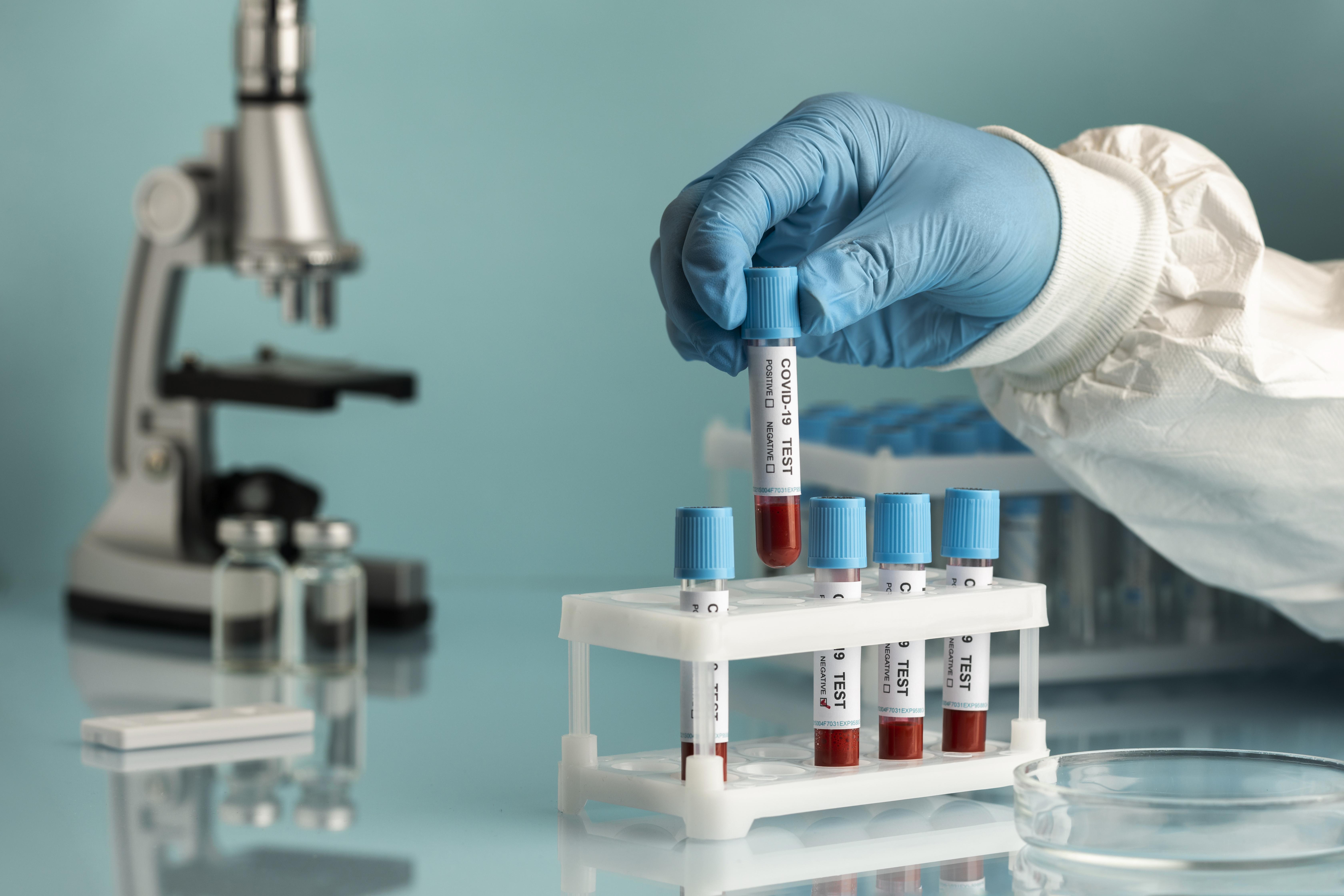 hand-with-protective-gloves-holding-blood-samples-covid-test (1).jpg