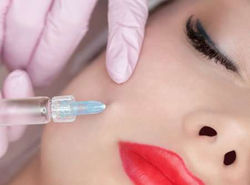 RELLENO FACIAL CON RADIESSE