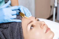 PRP FACIAL 120 €