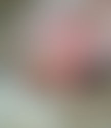 La mamelle, un organe à ne pas négliger