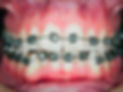 j06ehbw0zjw36xhc240saf018lsp.jpg