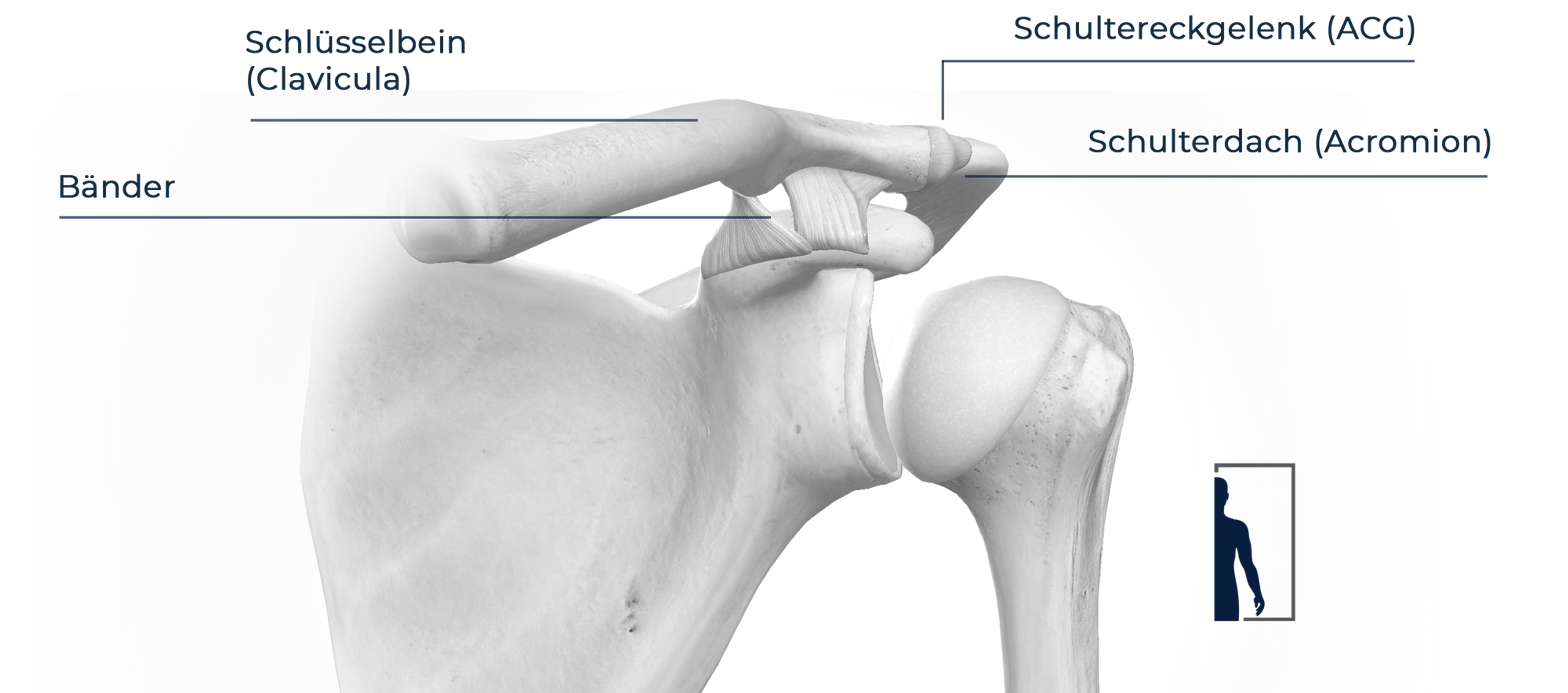 AC JOINT INJURIES I INSTABILITY