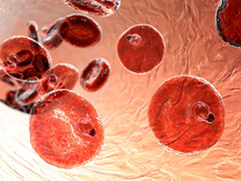 Rise in Malaria Deaths in Gauteng Raises Public Health Concern