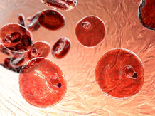 Rise in Malaria Deaths in Gauteng Raises Public Health Concern