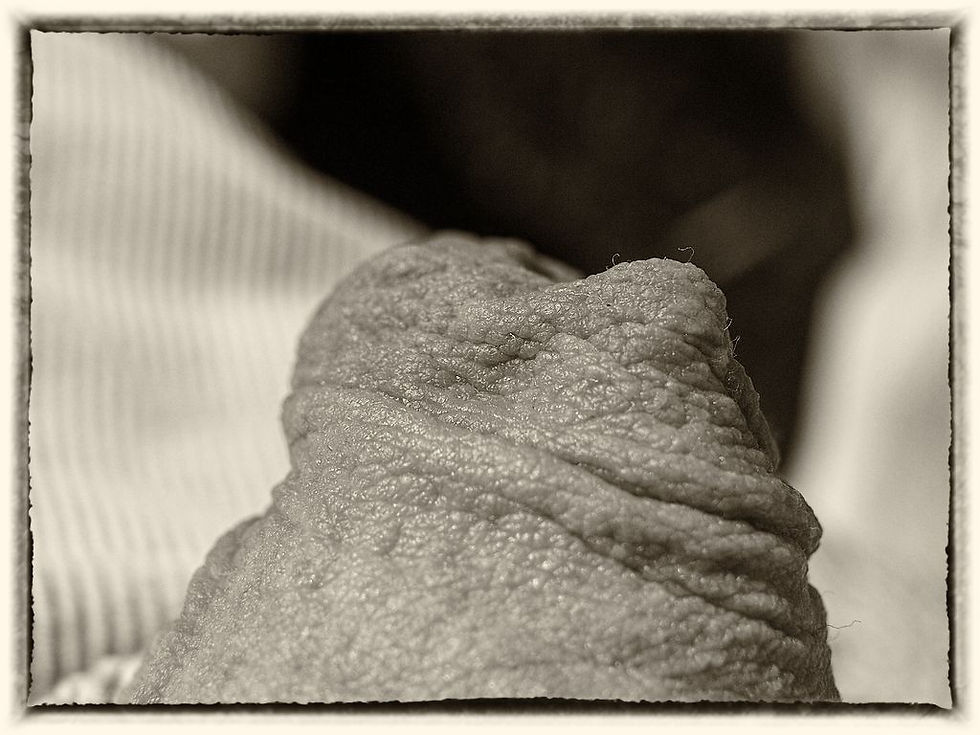 Vorhaut I