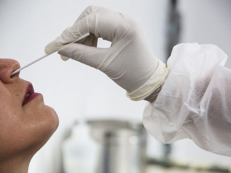 RN tem 28,5 mil testes para Covid-19 que vencem até o fim de dezembro, diz Sesap