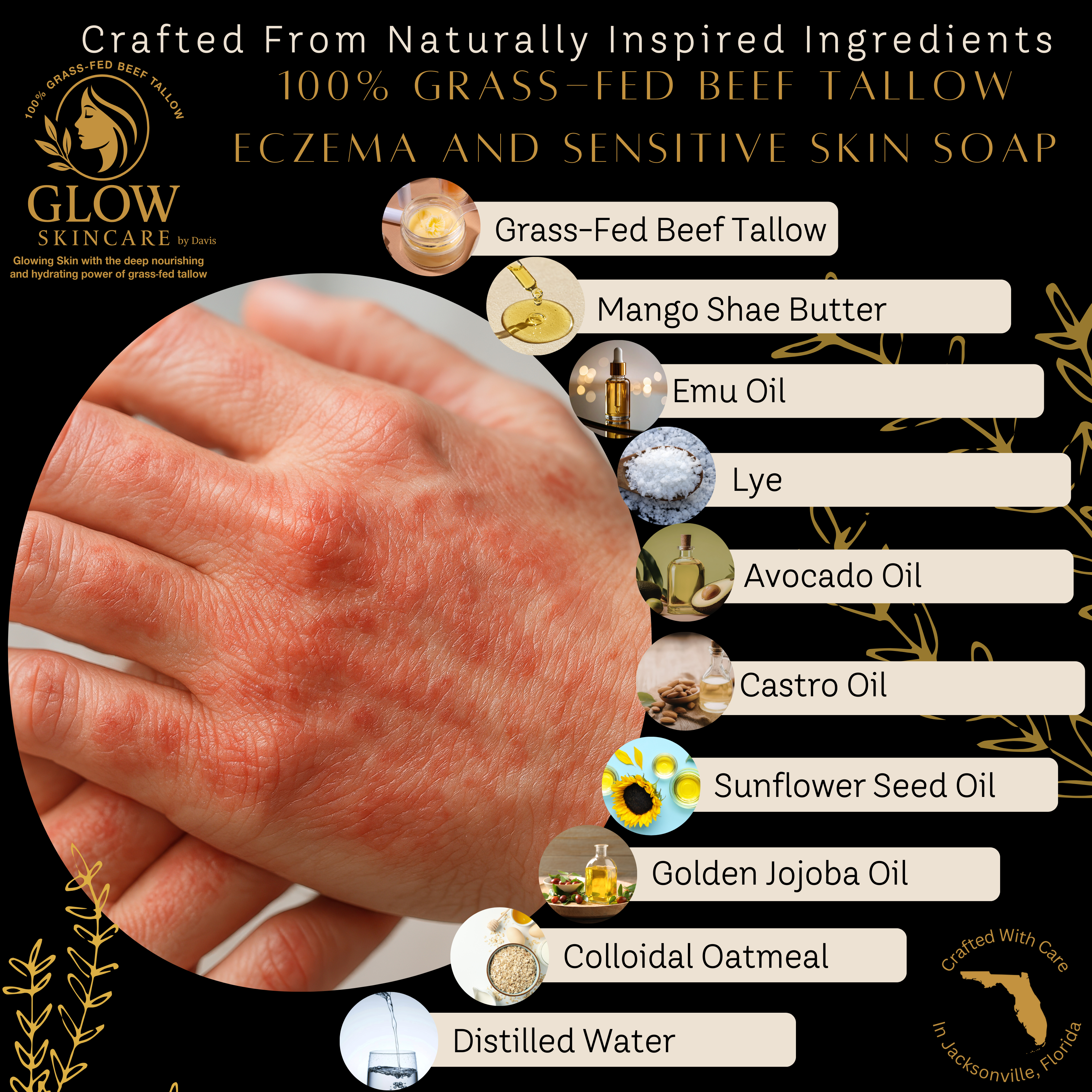 100% Grass-Fed Beef Tallow - Eczema and Sensitive Soap - 4oz