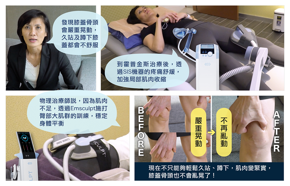 膝蓋疼痛.png