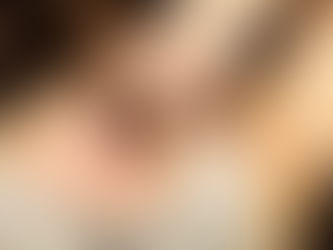 Effective Wart Treatment Options in Miami