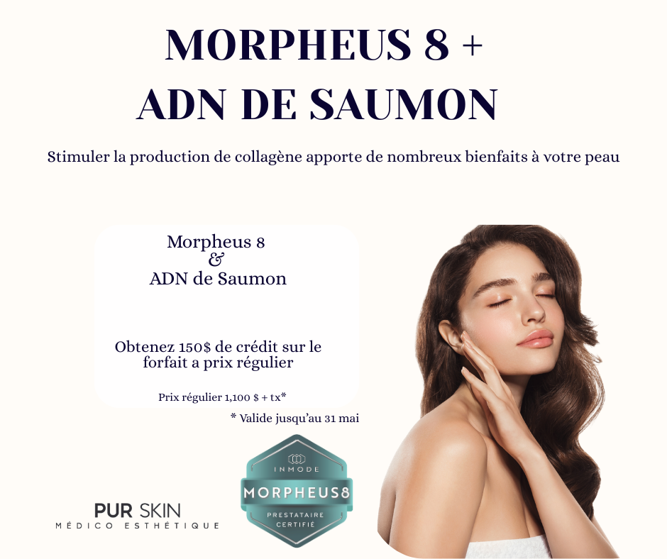 Dépôt 100$ Morpheus8 + ADN de Saumon 150$ de rabais sur un forfait/promo MAI