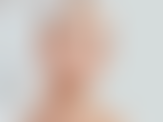 Skin Boosters ou Agents de Comblement : Que Choisir Pour Revitaliser Votre Peau?