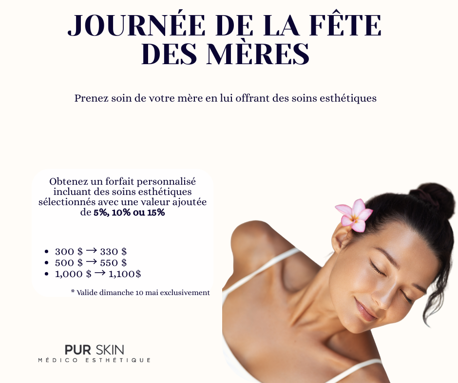 Dépôt de 50$ pour un forfait en soin esthétique fête des mères/promo MAI
