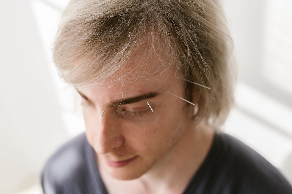Dry Needling for Jaw Pain: What to Expect and How It Is Used