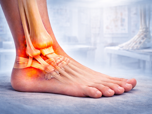 Ankle Ligaments: Understanding Injuries, Symptoms, and When to See a Physiotherapist