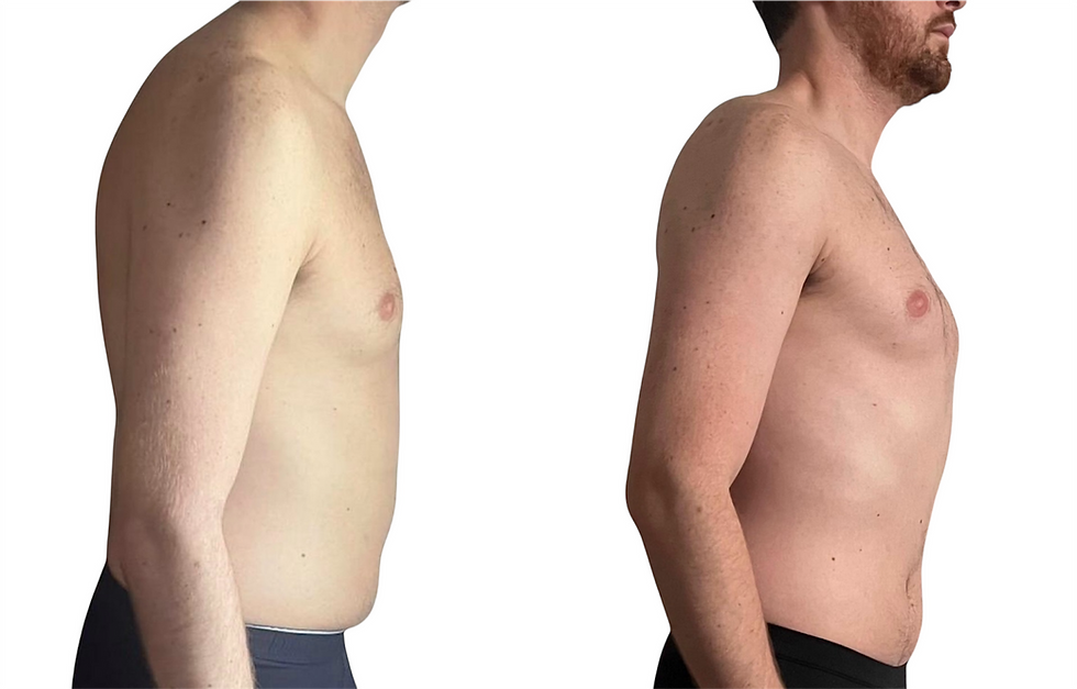Person with upright posture and expanded ribcage after breathwork and mobility training, demonstrating improved shoulder alignment and thoracic extension.