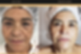 Antes%252520y%252520despues%252520face%252520%2525232_edited_edited_edited.png