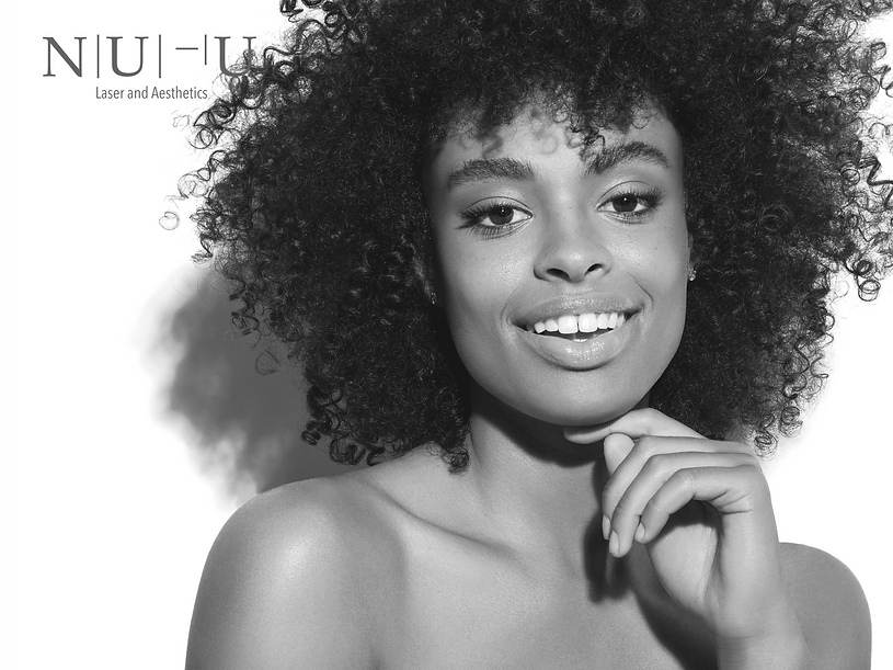 Image of a woman with white teeth - laser teeth whitening clinic - NU-U Laser and Aesthetics Clinic in Hebden Bridge, West Yorkshire Todmorden Hebden Bridge Halifax Leeds Manchester