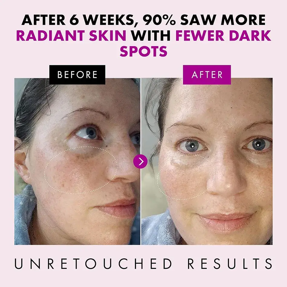 Thumbnail: 50g Collagen Face Cream Nourish Plump Up Skin,fresh Texture Cream Make Skin Youn