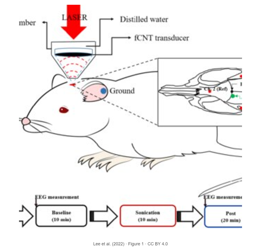 Electroencephalographic Response of Brain Stimulation by Shock Waves from Laser Generated Carbon Nanotube Transducer
